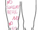Leg with the words No surgery here no no no written on it